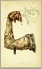 Flexed Arm from early 20th Century